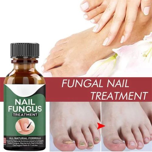 Fast Nail Fungal Treatments Nail Repair Essences Serum Care Treatments Foot Nail Fungus Removal Gel,   Up to 50,000 trusted peoples